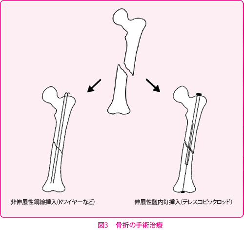 2 上肢 下肢